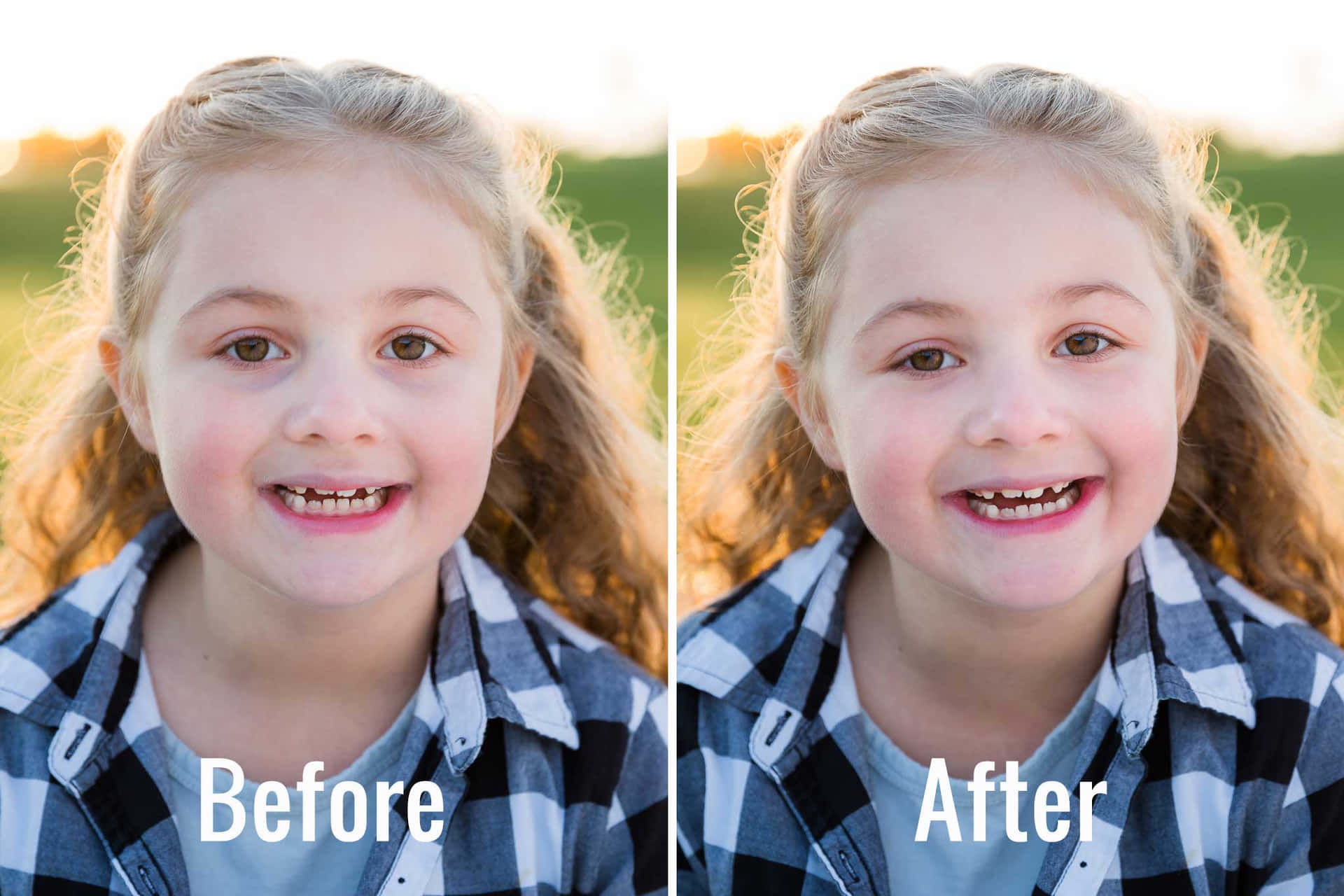 A Girl With Teeth Before And After Photoshop