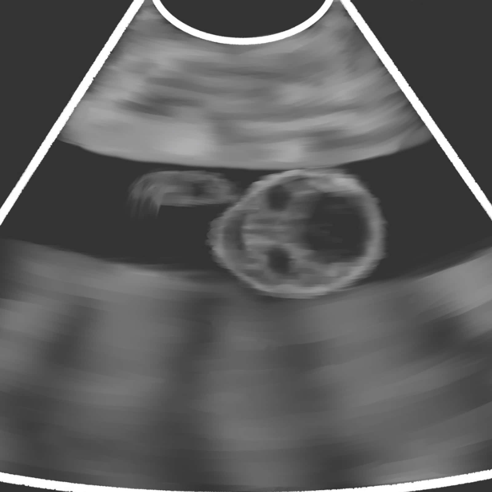 A Glimpse into the Fun Side of Pregnancy - Hilarious Ultrasound Image